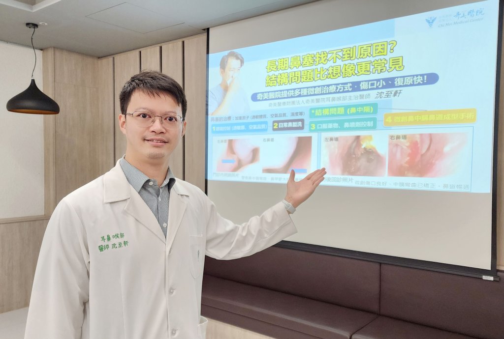 鼻塞難解不等於過敏！奇美醫院專家揭開鼻腔結構異常的真相