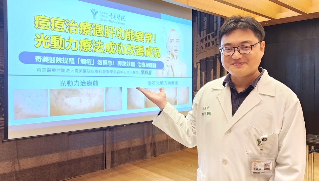 「爛痘」勿輕忽！奇美醫院光動力療法成功改善膚況