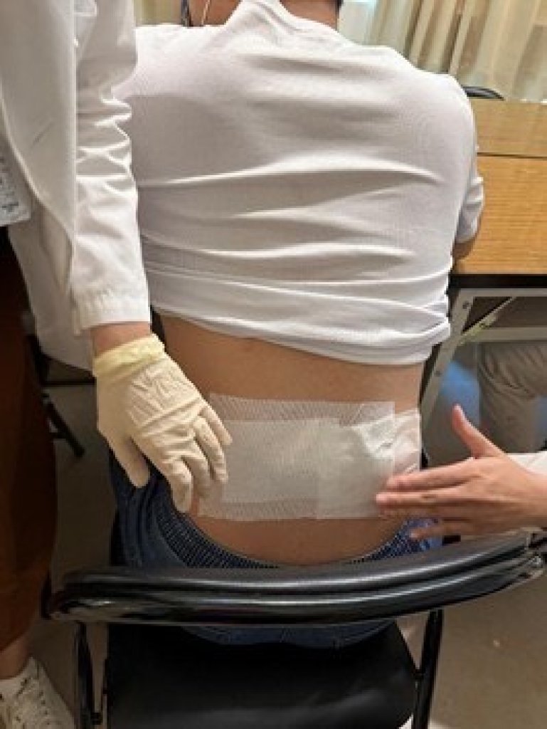 安南醫院中醫部-三九貼 祛除寒邪提高身體抗病力