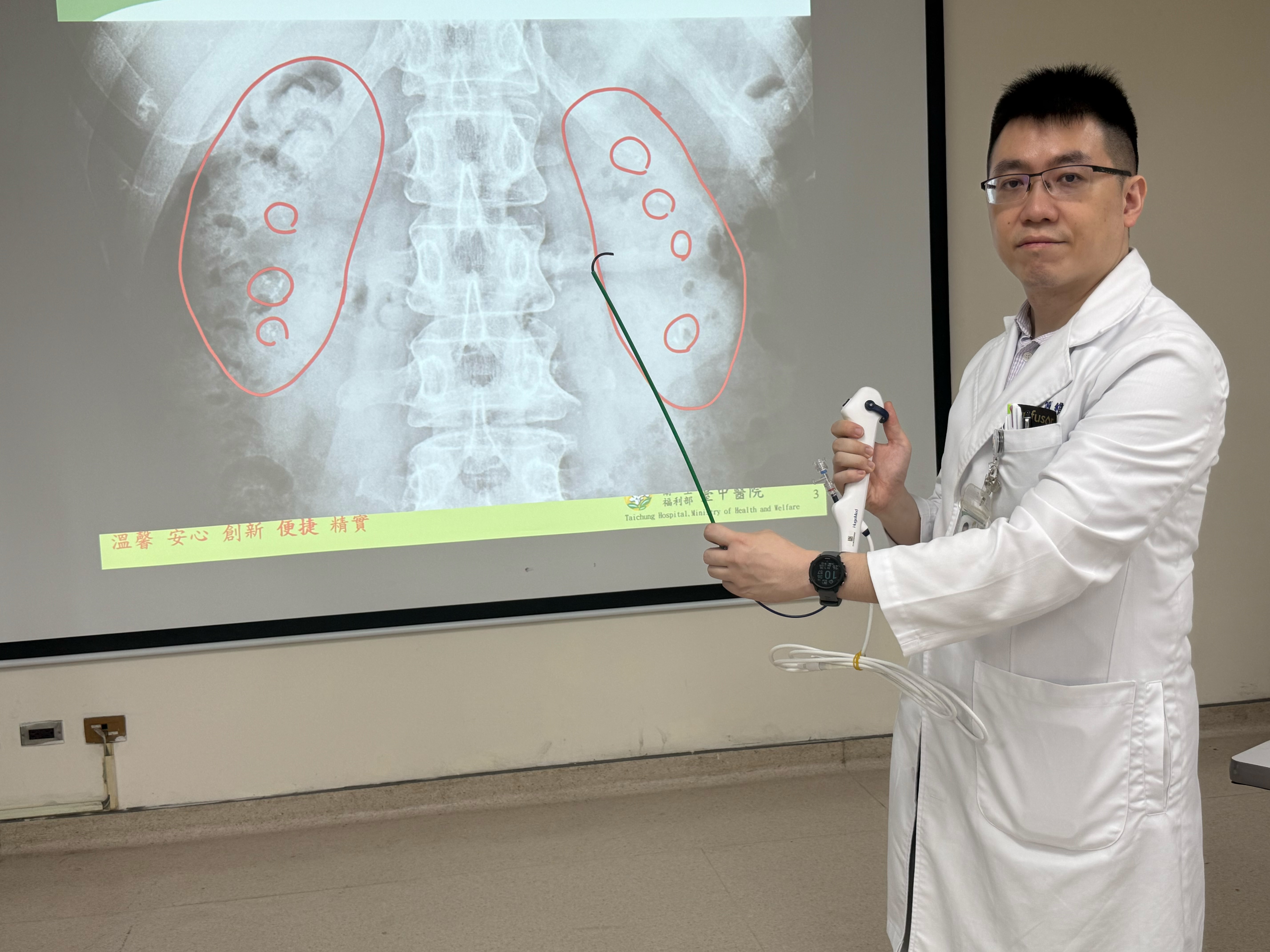 衛生福利部臺中醫院泌尿科簡維弘醫師說明，患者X光片顯示雙側腎臟內都有明顯的「雷射斑」，宛如兩顆鑲滿葡萄乾的雜糧麵包。