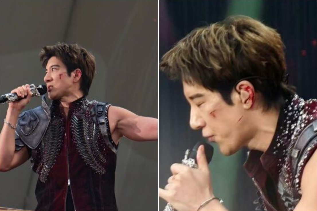王力宏演唱會摔倒，左臉左耳鮮血直流。（圖／翻攝微博）