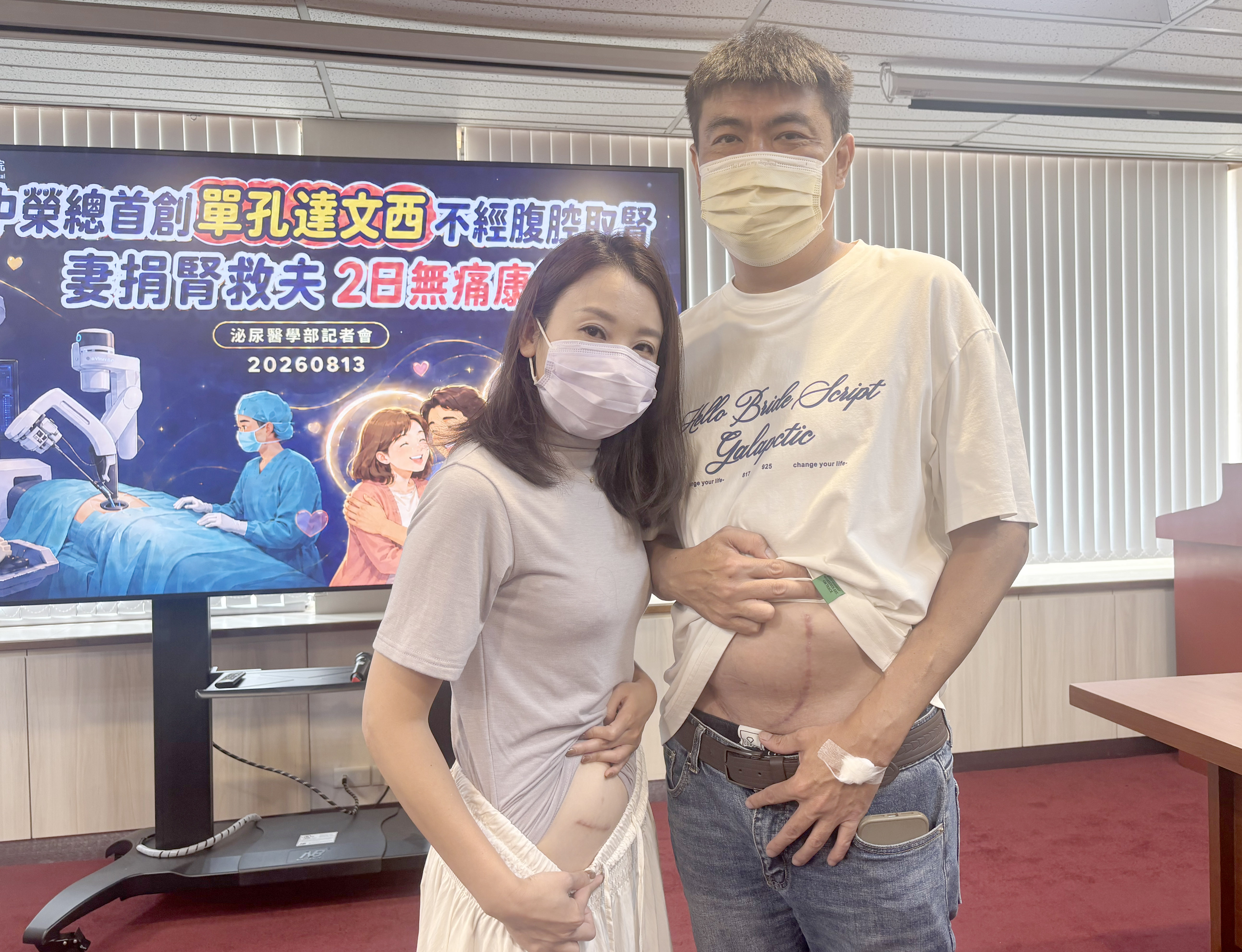 劉小姐(左)採單孔達文西手術取右腎捐給丈夫賴先生(右)。在腹部留下一個取腎疤痕。中榮提供
