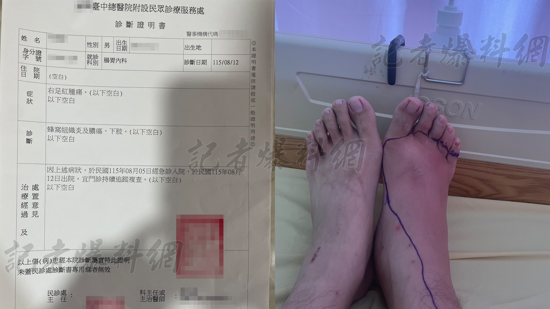 ▲成功嶺替代役再爆醜聞！役男就醫遭幹部放生，延誤治療釀「蜂窩性組織炎」險截肢（圖／記者王俊勝 翻攝）