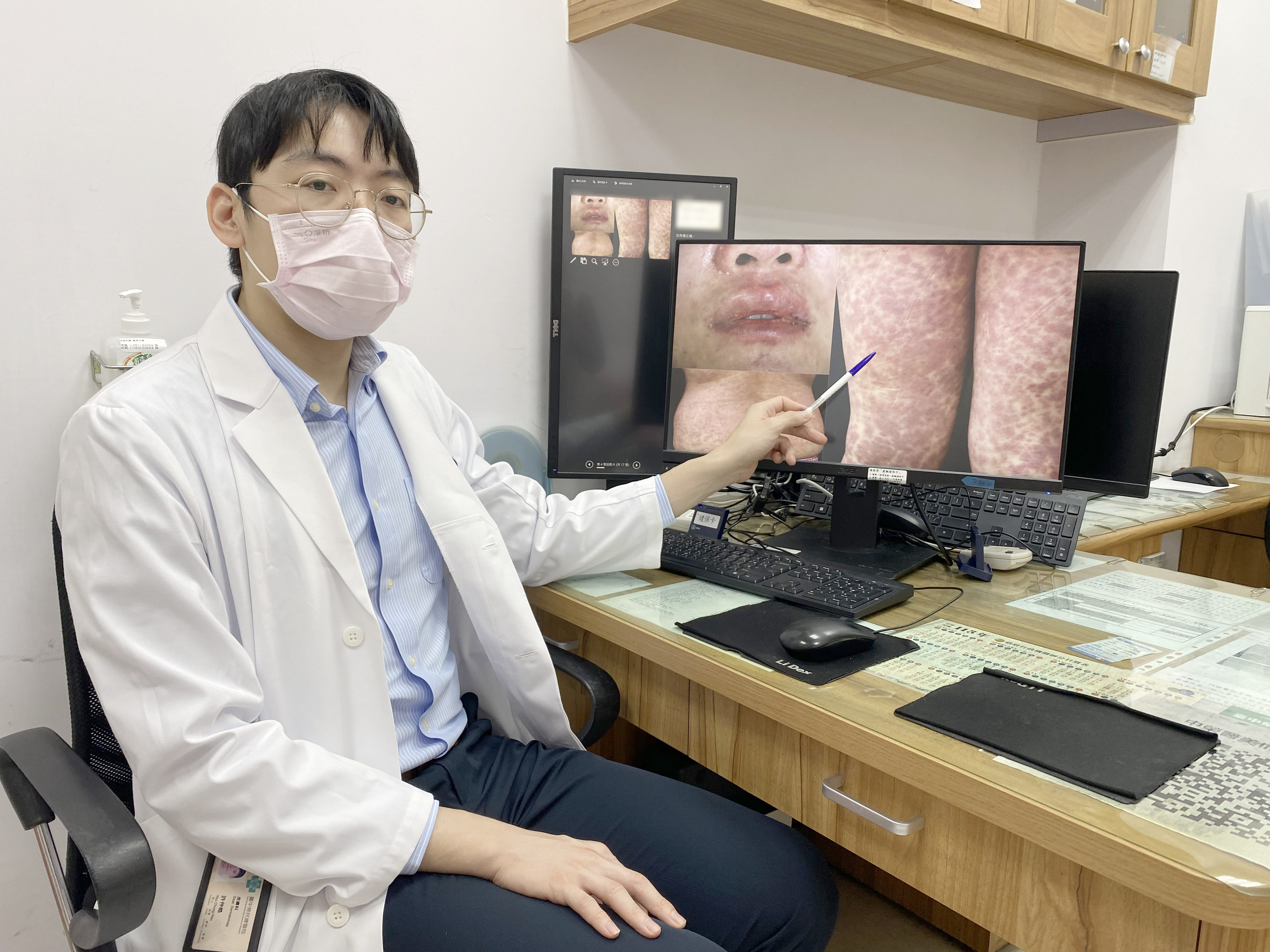 (hand pointing up)臺中榮總皮膚科醫師許仲皓指出，「藥物反應合併嗜酸性球及全身症狀」是一種嚴重的全身藥物過敏反應，通常在病人服用藥物後2至6周後，發生全身紅疹症狀。