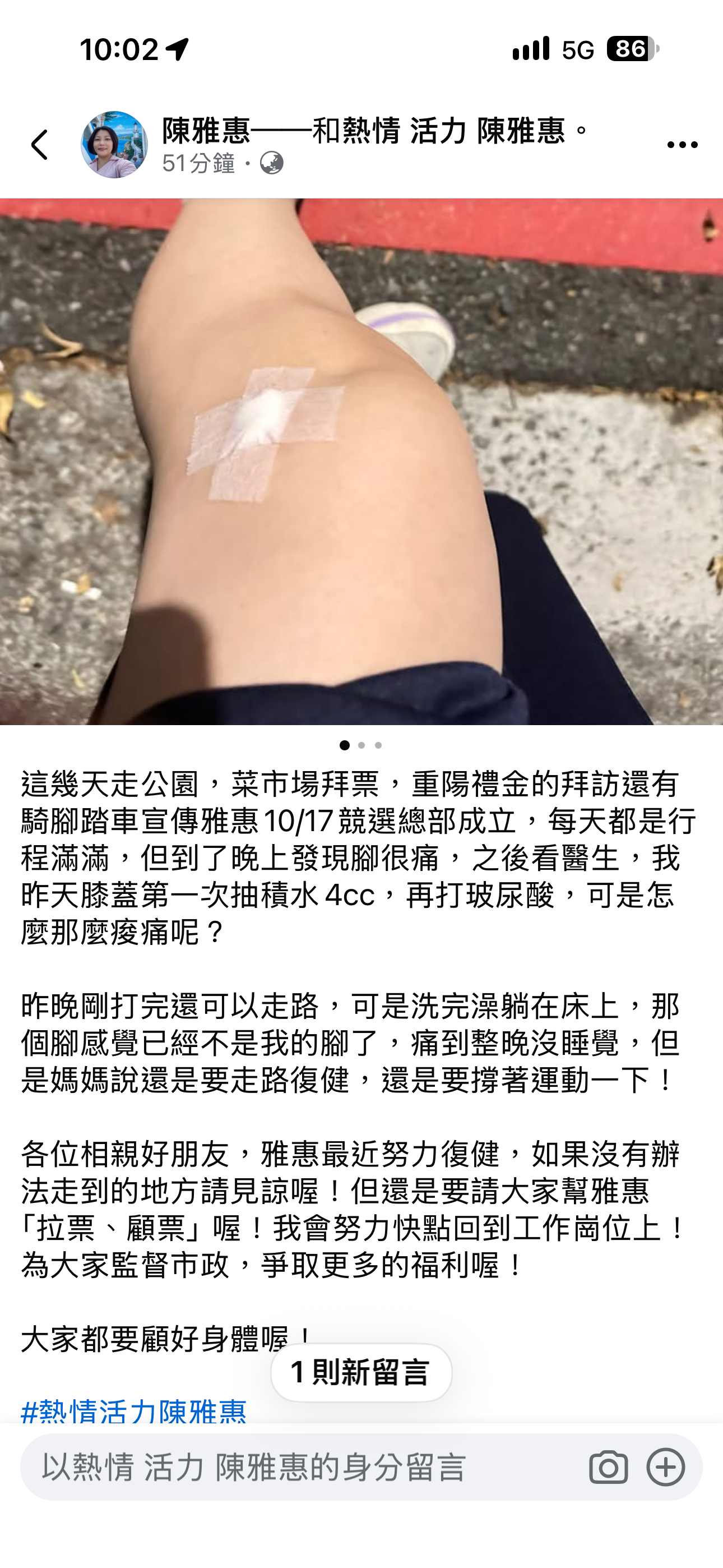 陳雅惠在臉書放上她腳部就醫的照片,引發許多民眾的關注。