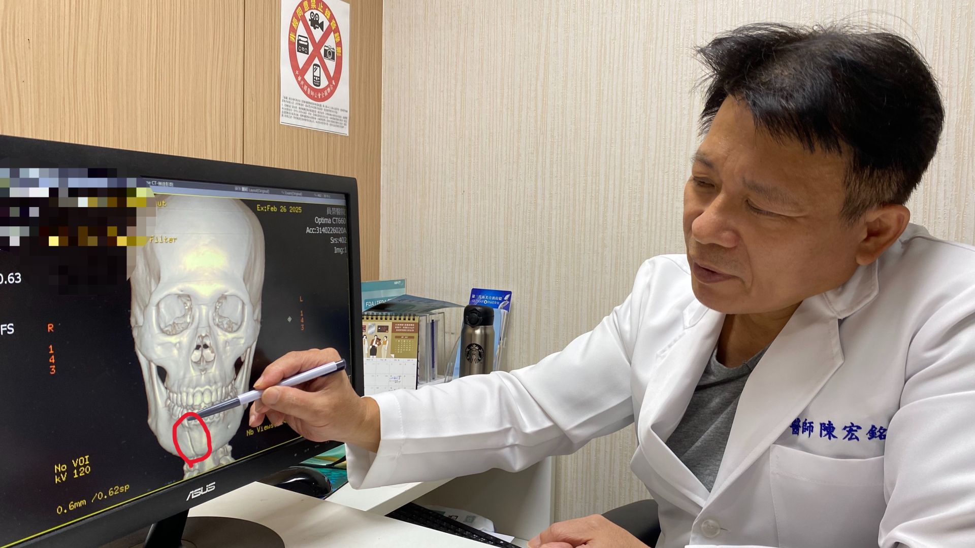 顏面受傷可能傷及骨頭 員榮陳宏銘醫師呼籲患者把握黃金治療期