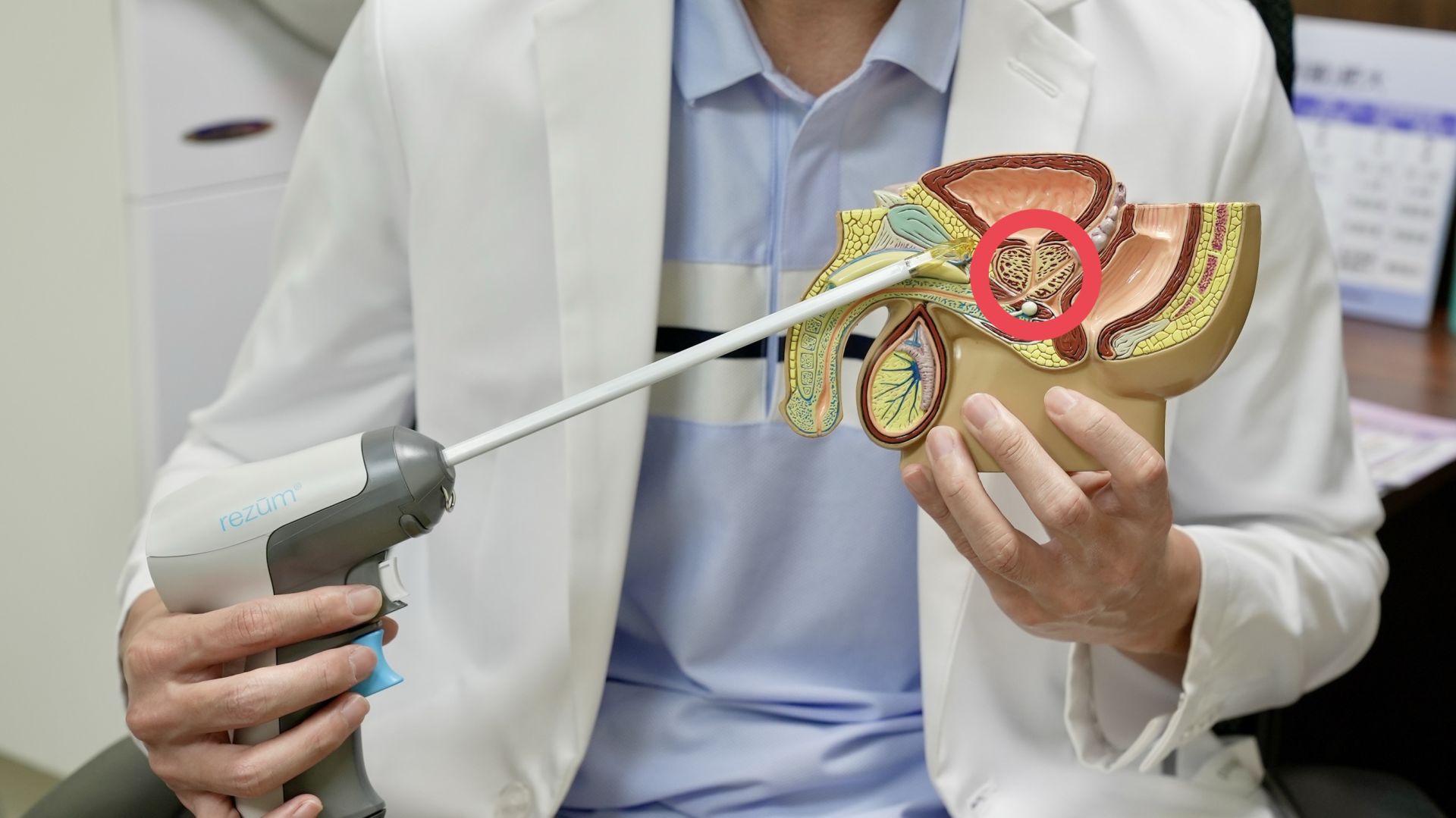 攝護腺水蒸氣手術  91歲老翁擺脫尿管 重獲順暢人生