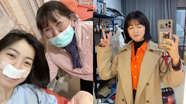 米可白分享手術後心得。（圖／翻攝米可白​IG）