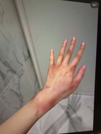 Jisoo親哥妻子出面，控告遭老公家暴。（圖／翻攝theqoo）