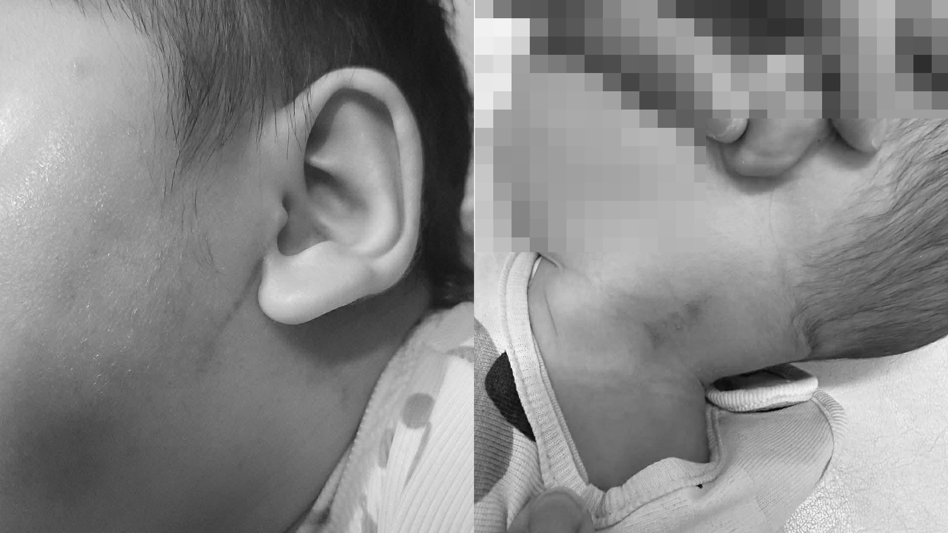 ▲童身上有多處明顯傷痕（圖／郭國文辦公室 提供）