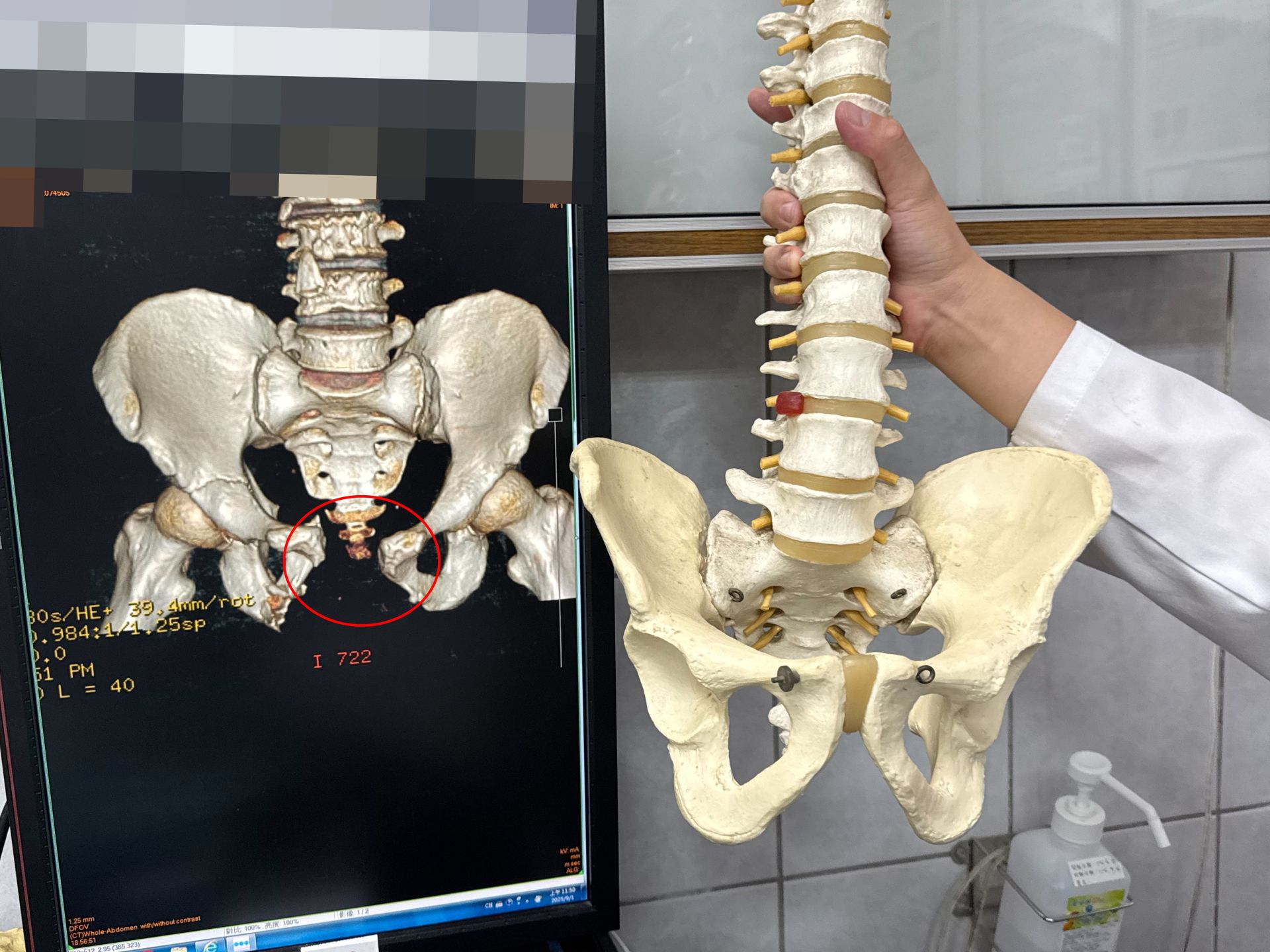 遭重擊!失血1/3、骨盆爆、腸外露 醫師鬼門關前救人