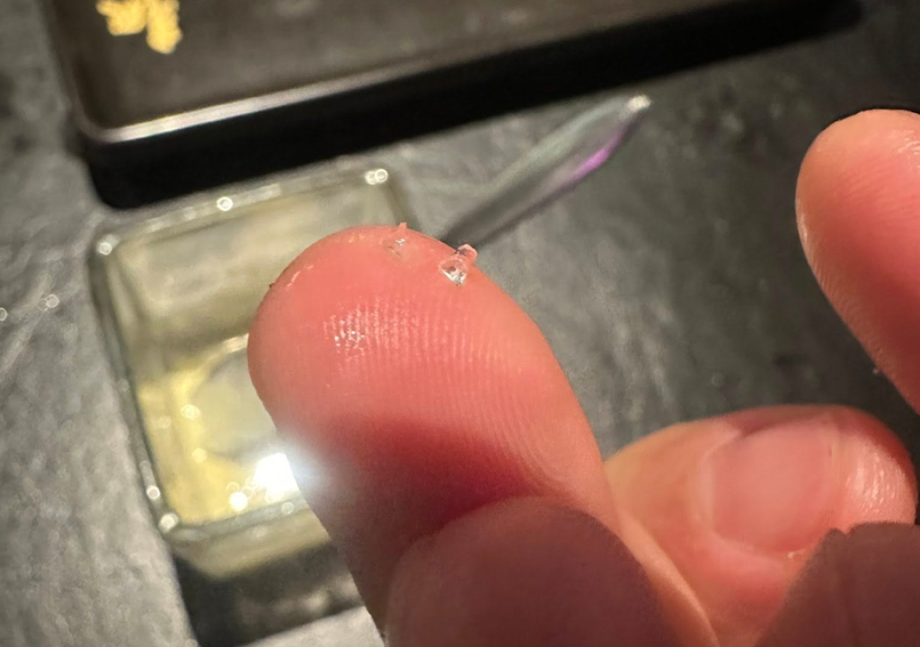 火鍋店冰淇淋「吃到碎玻璃」喉嚨出血！稱X光照出大塊玻璃　消費者：已委任律師處理