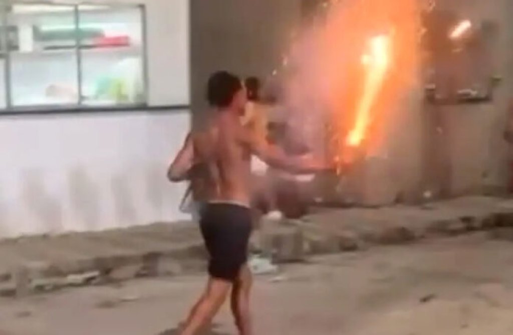 影／巴西男拿火焰劍突爆炸！右手遭炎之呼吸吞噬　血肉模糊拇指截肢