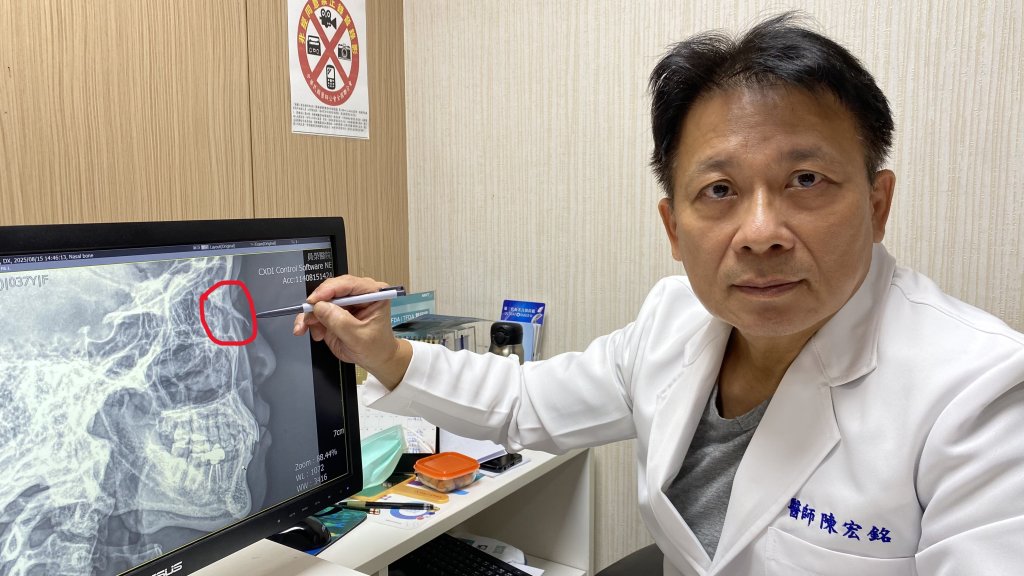 顏面受傷可能傷及骨頭 員榮陳宏銘醫師呼籲患者把握黃金治療期