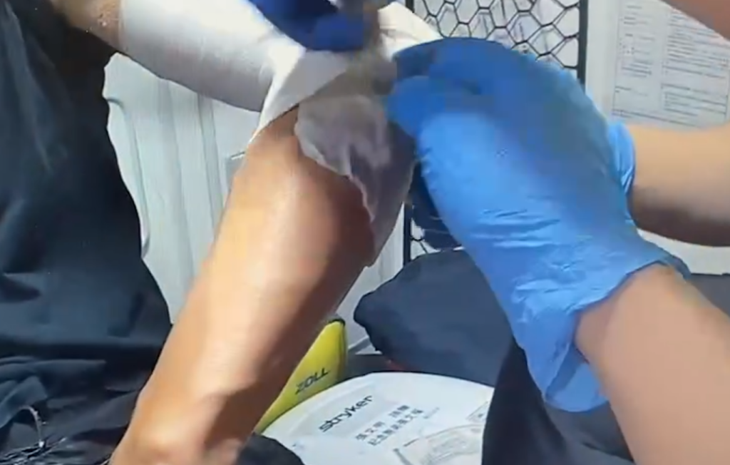 竹北串燒酒場氣爆！ 　1員工多處二度燒燙傷送醫