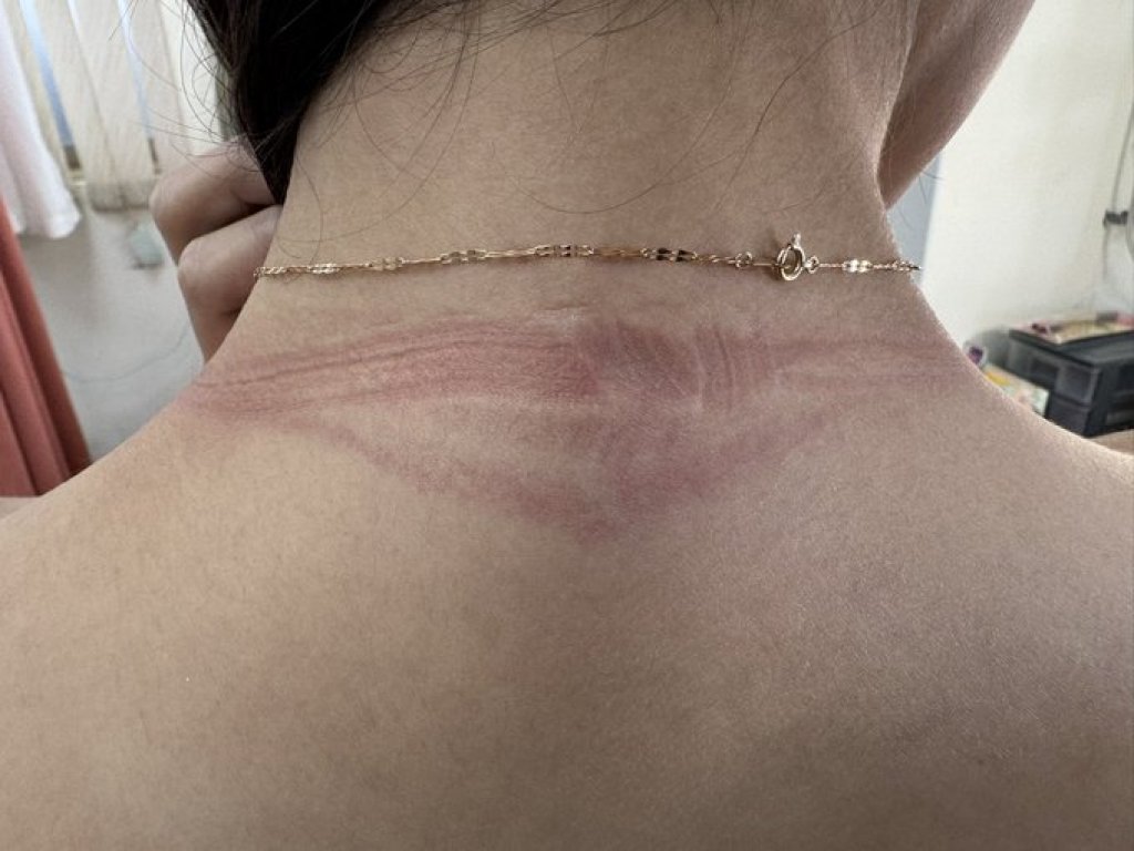 L罩杯AV女優田野憂「職業傷害」！7公斤巨乳常穿比基尼　後頸出現深深勒痕