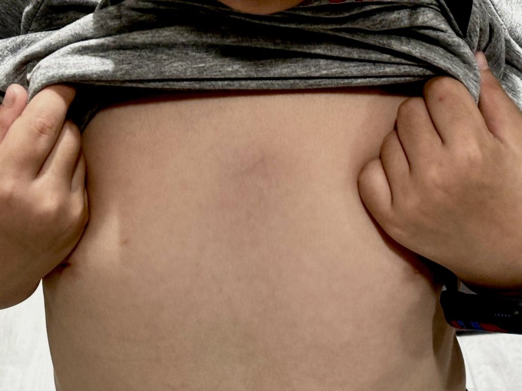 台南安親班爆「肘擊6歲童」！胸口大片瘀青　家長怒驗傷、教育局開罰了