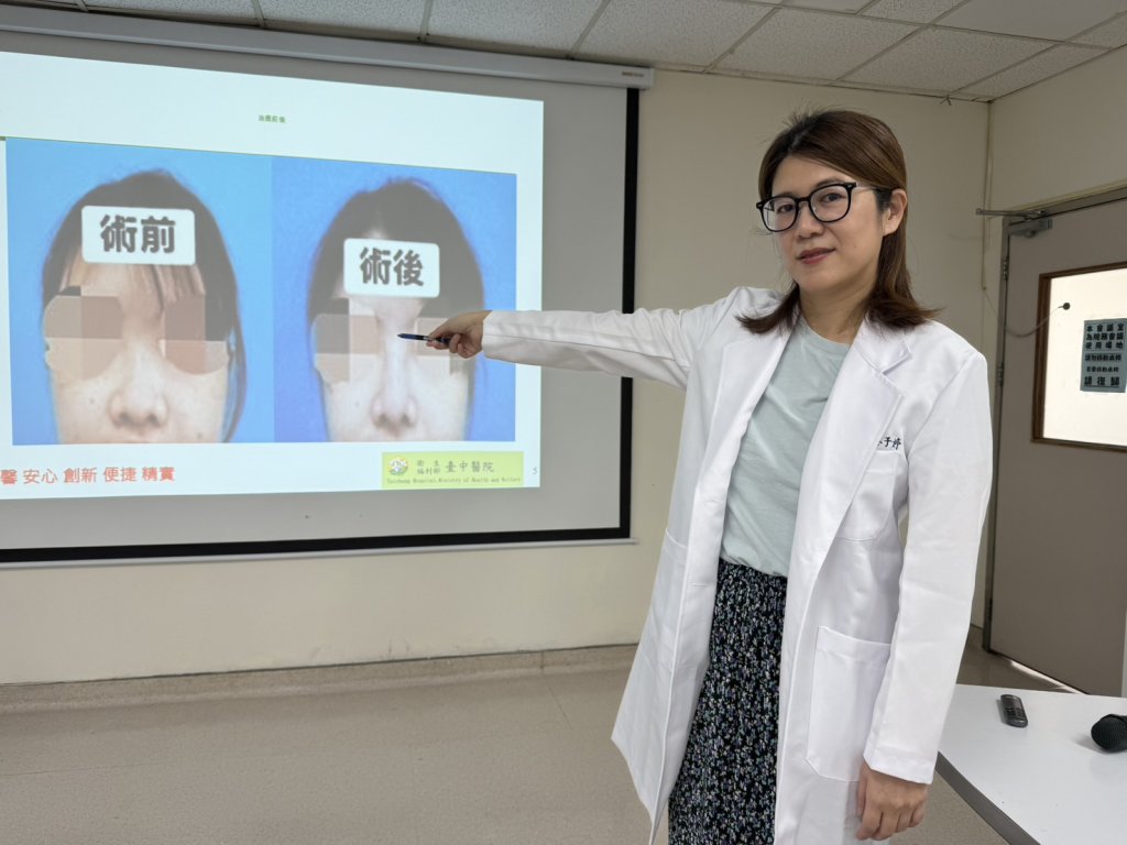 蘋果姐姐遇車禍撞歪鼻子   這手術讓她重建堅挺鼻樑大口呼吸