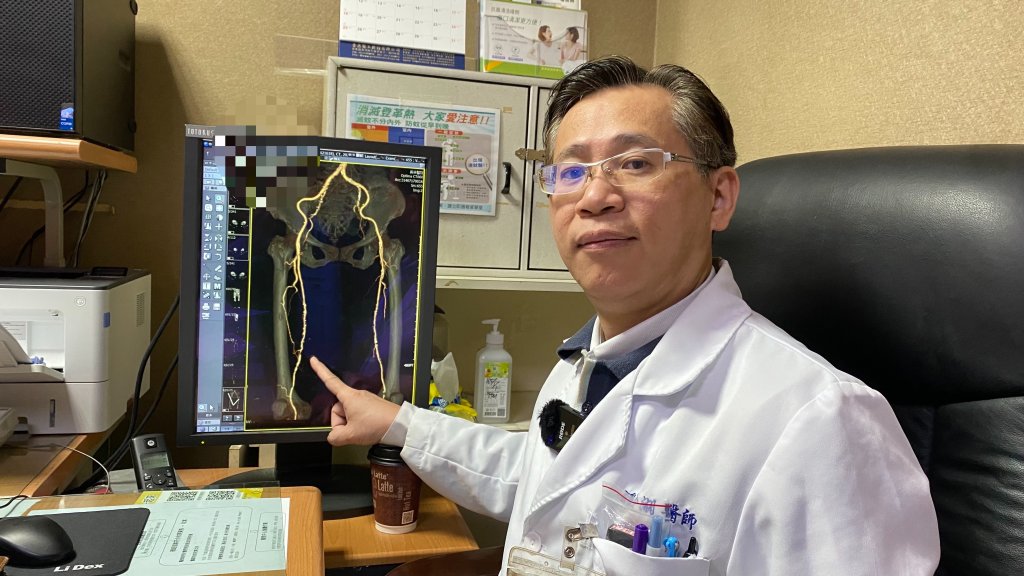 傷口潰瘍久醫不癒 糖尿病動靜脈「雙重循環不良」惹的禍