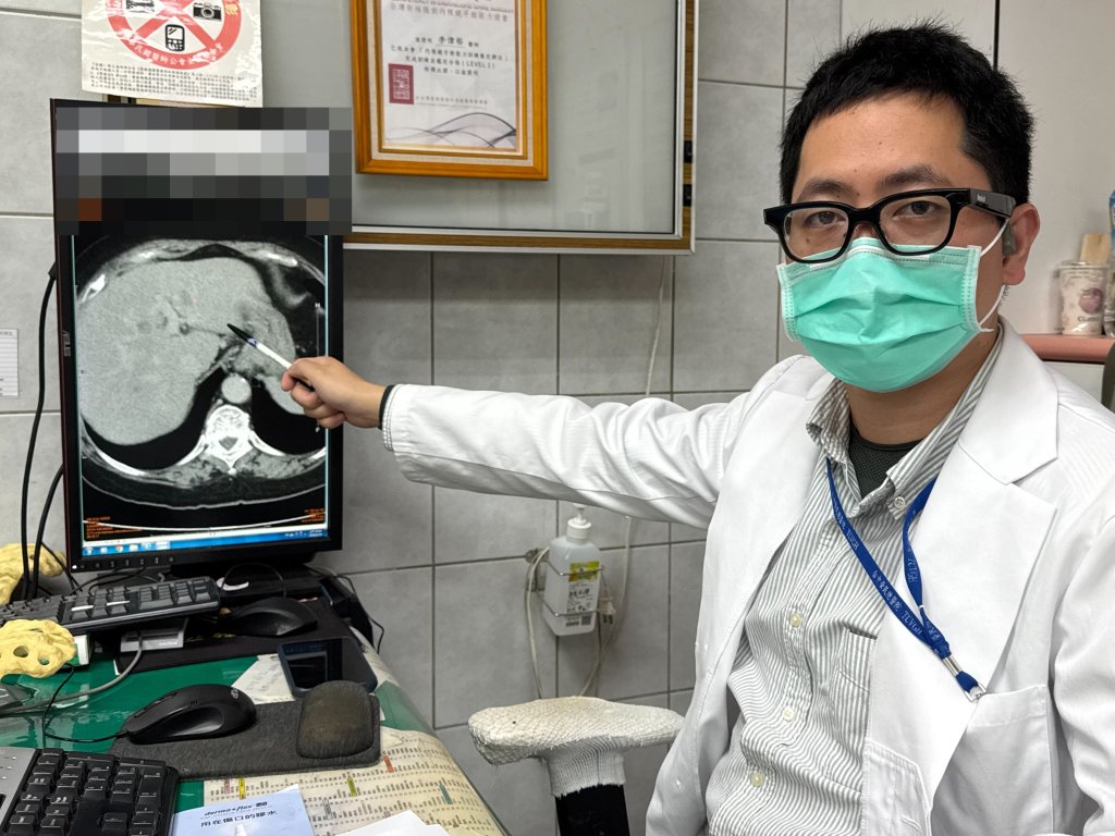 婦嗜好甜食逾六成全是脂肪肝 病變釀成癌