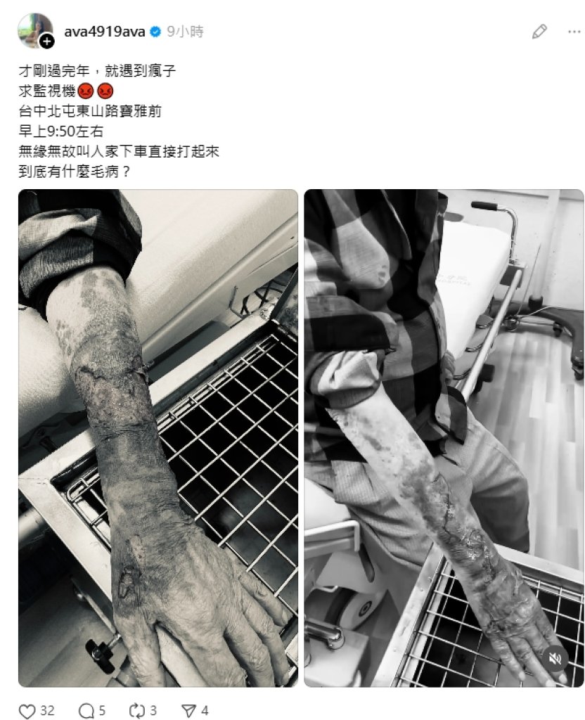 寶雅前遭陌生騎士攔車毆打 受害者曝傷勢求監視器