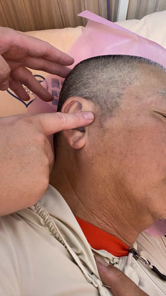 扁桃腺癌患者放療後耳鳴副作用大到住院 員榮中醫師針藥讓他重拾正常生活