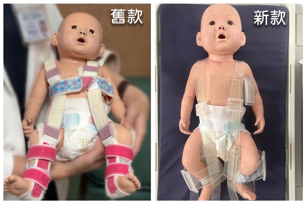 新生兒透光型髖關節隱形矯具  彰基榮獲阿基米德發明展金獎與特別獎