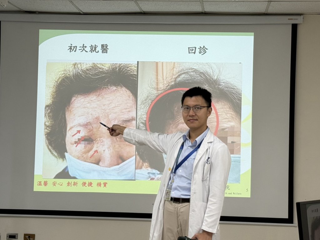 婦眼角冒水皰竟是「皮蛇」入侵！ 醫療團隊即時診治化解危機