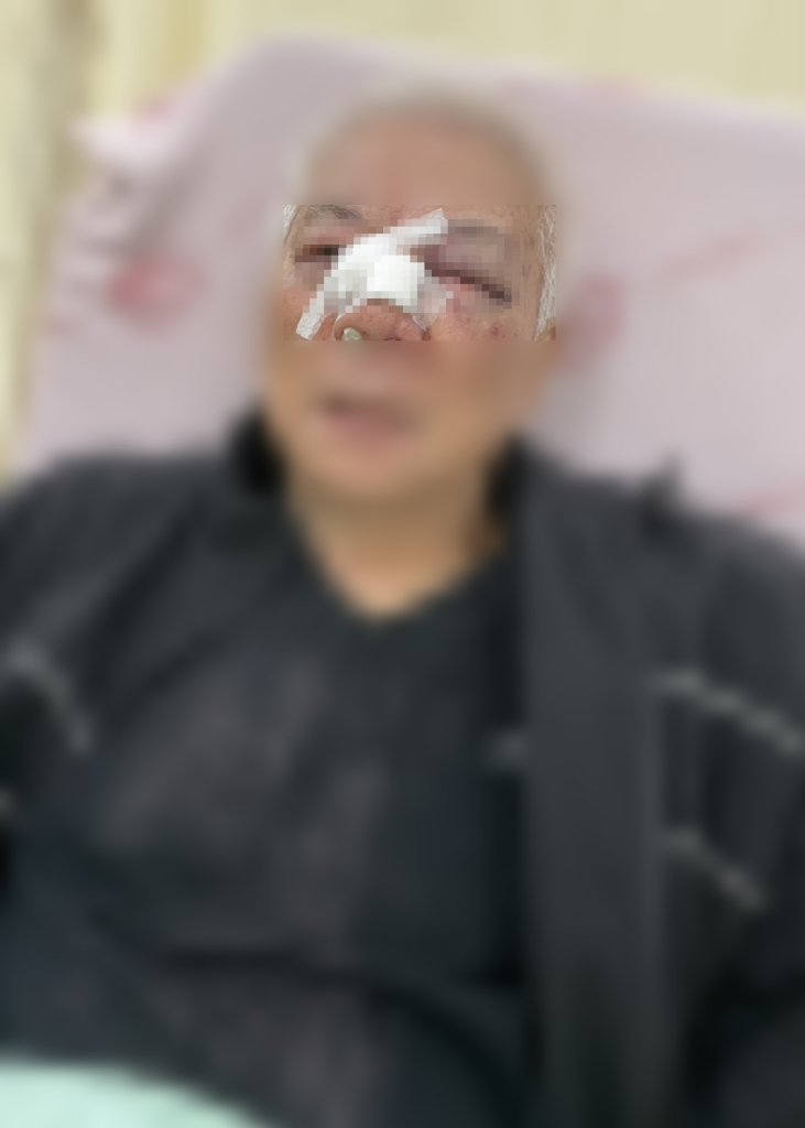 台中雜擦貨店老闆遭鑰匙刺穿鼻樑！ 　家人：「被奇怪的人謀殺式攻擊」