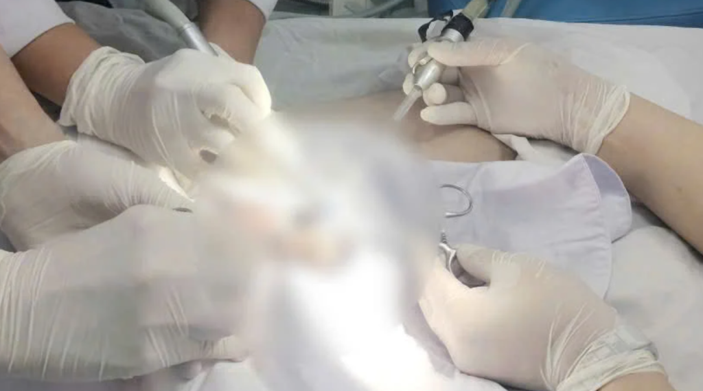 下體卡19公分扳手！越南男「好奇硬塞」拔不下來　GG劇痛忍無可忍急求救
