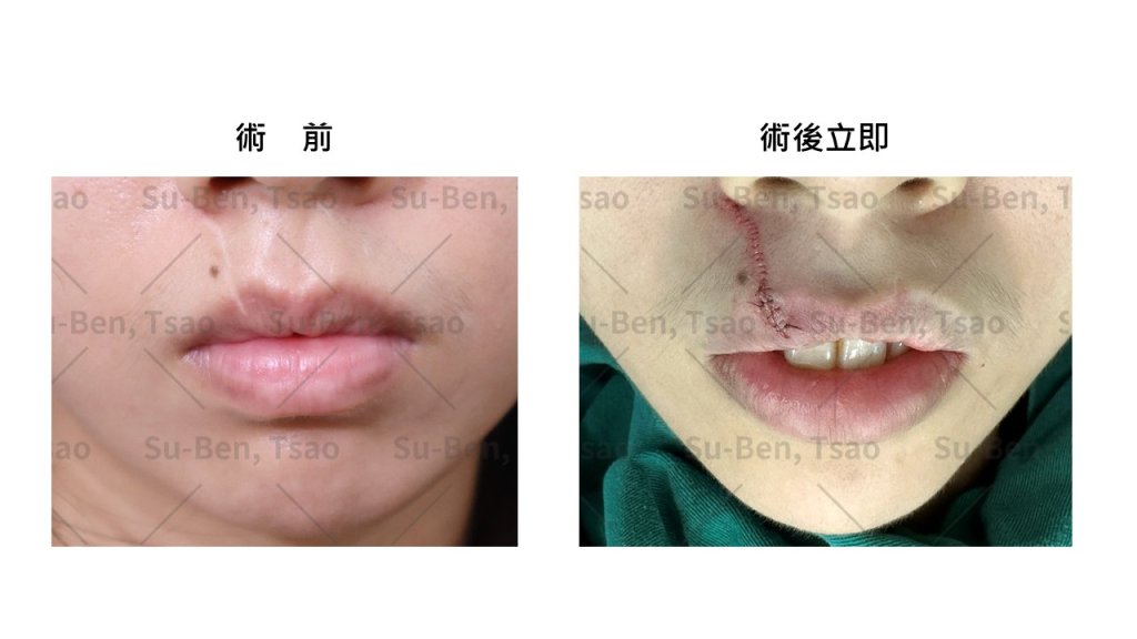 寵物當家抓咬唇部白疤有救 養主重拾失落平安