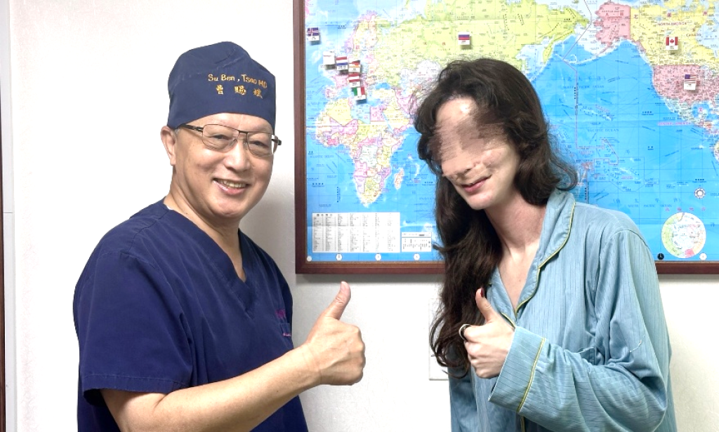 白疤之父曹賜斌妙手回春      德國靚女來台除臉蛋白疤不虛此行 