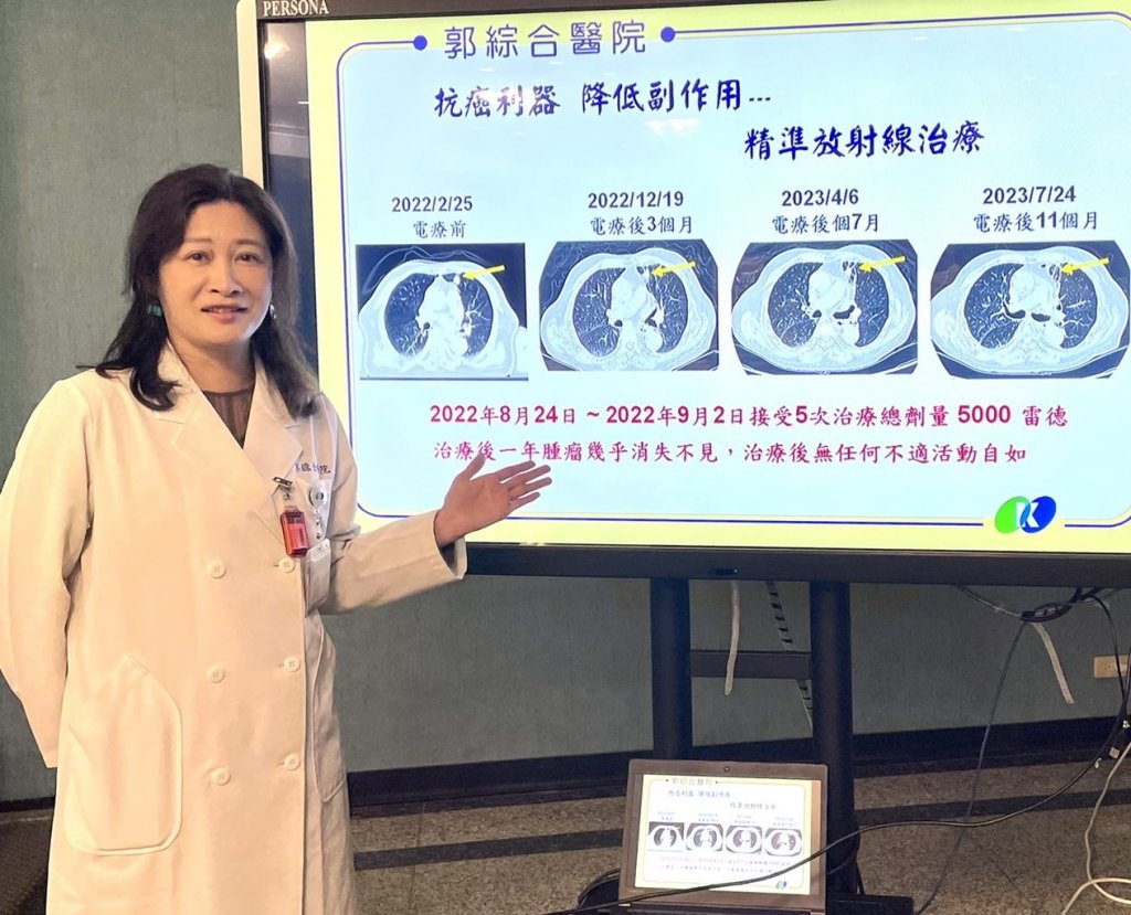 八旬翁早期肺癌 Versa HD奈米刀  降低副作用