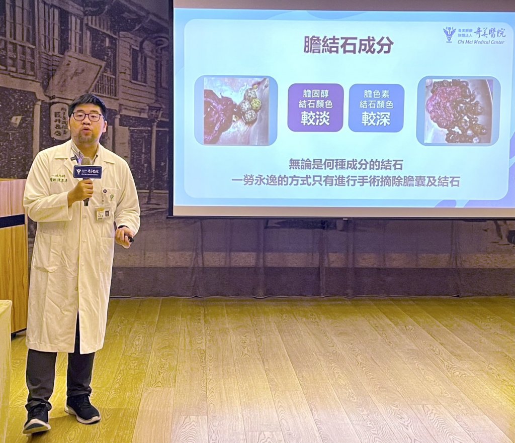 婦大啖美食後噁心又腹痛 腹腔鏡膽囊切除手術改善