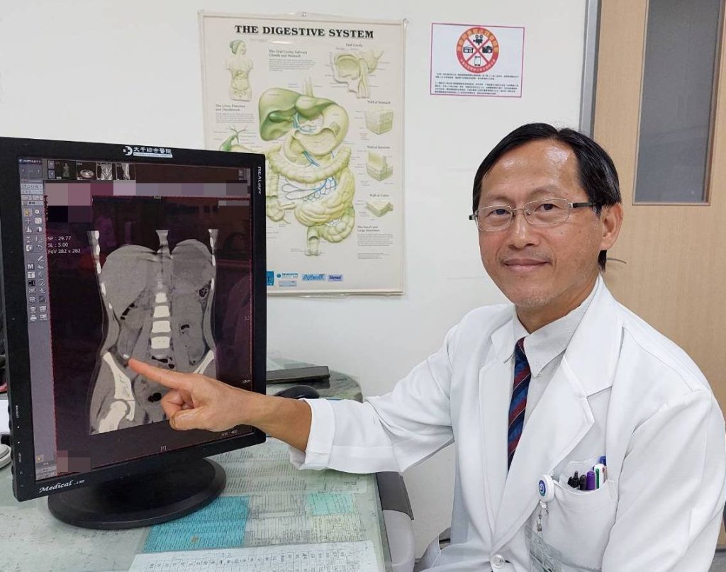 4歲幼童嘔吐、腹痛誤為腸胃炎  檢查竟是急性闌尾炎破裂合併腹膜炎