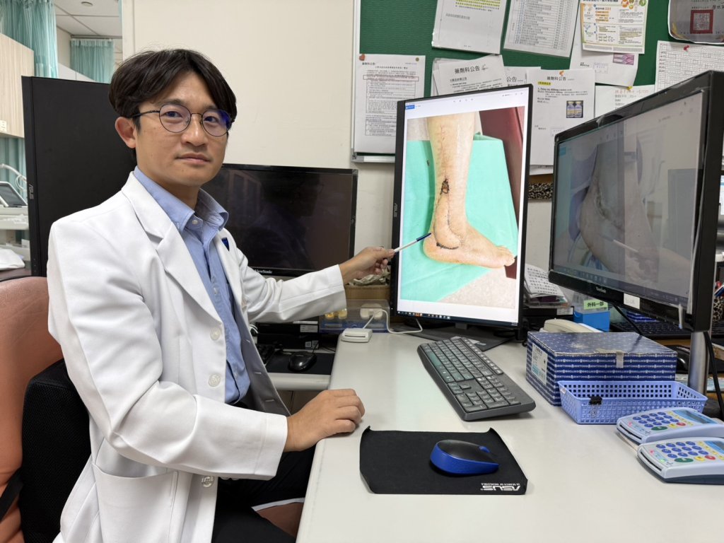 高榮南院骨科運用AI輔助皮瓣重建慢性外踝潰瘍  緩解神經性疼痛   