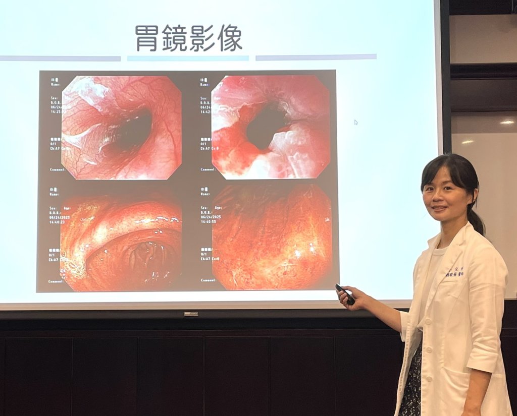 誤飲鹽酸灼傷食道與胃黏膜 醫師提醒：「三不一就醫」處理原則
