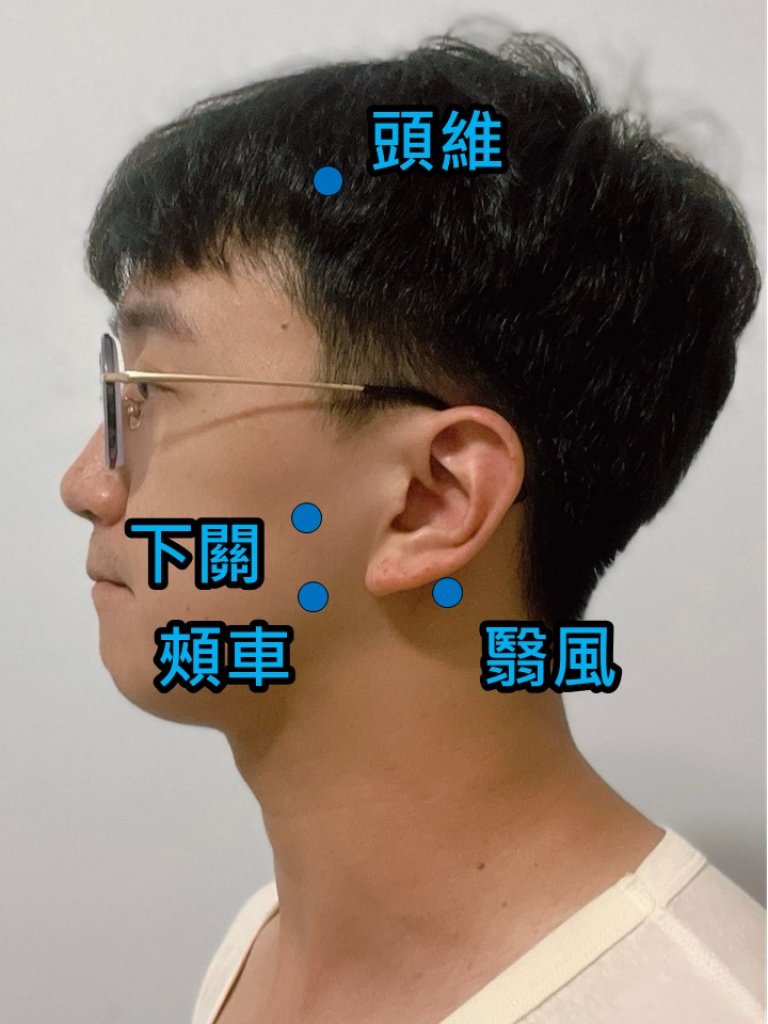 張嘴喀喀聲連帶耳鳴、肩頸僵硬　中醫針灸助患者重拾輕鬆
