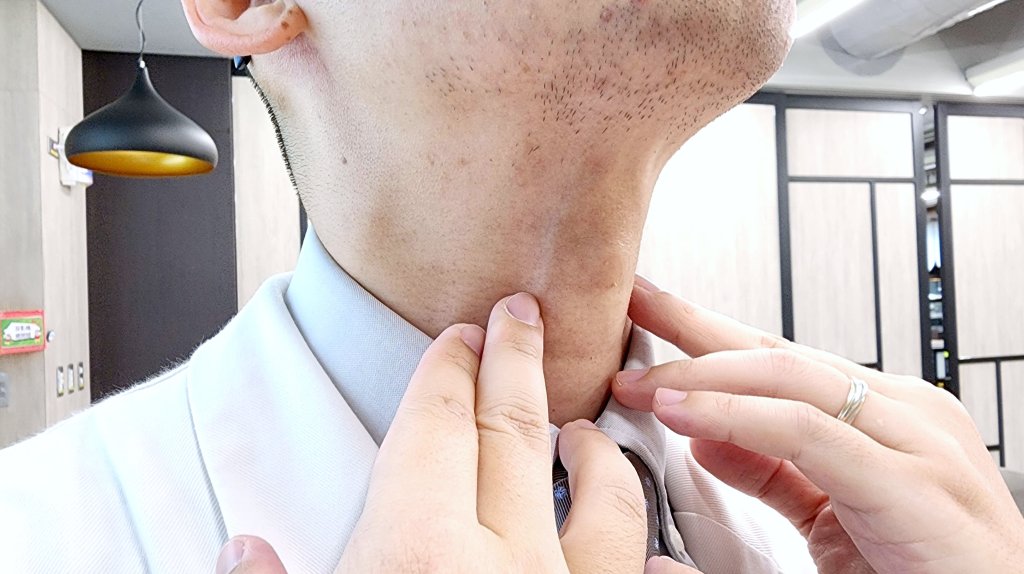 七旬翁腦中風吞嚥困難仰賴鼻胃管，奇美醫院AI輔助重拾生活品質