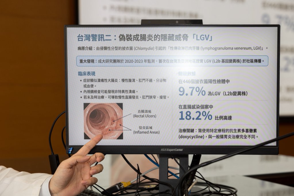 【性傳染腸道病原】醫師：不明原因腹瀉、血便超過三天應就醫