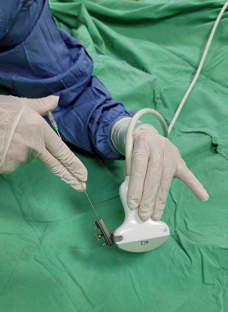 高齡長輩攝護腺肥大併發大出血　民生醫院泌尿科團隊緊急手術助轉危為安