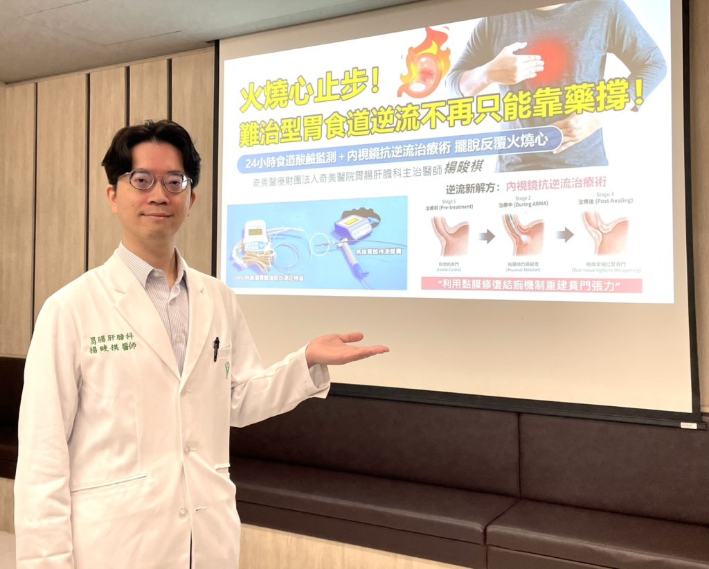 難治型胃食道逆流！食道酸鹼監測＋內視鏡抗逆流治療術，擺脫反覆火燒心