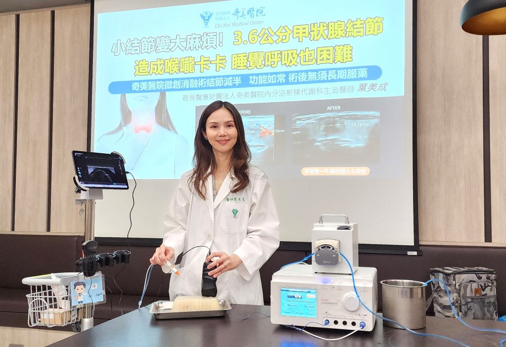婦人3.6公分甲狀腺結節 奇美醫院微創消融術結節減半、功能如常，術後無須長期服藥